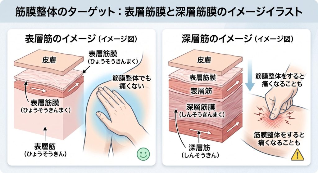 青山筋膜整体 痛い